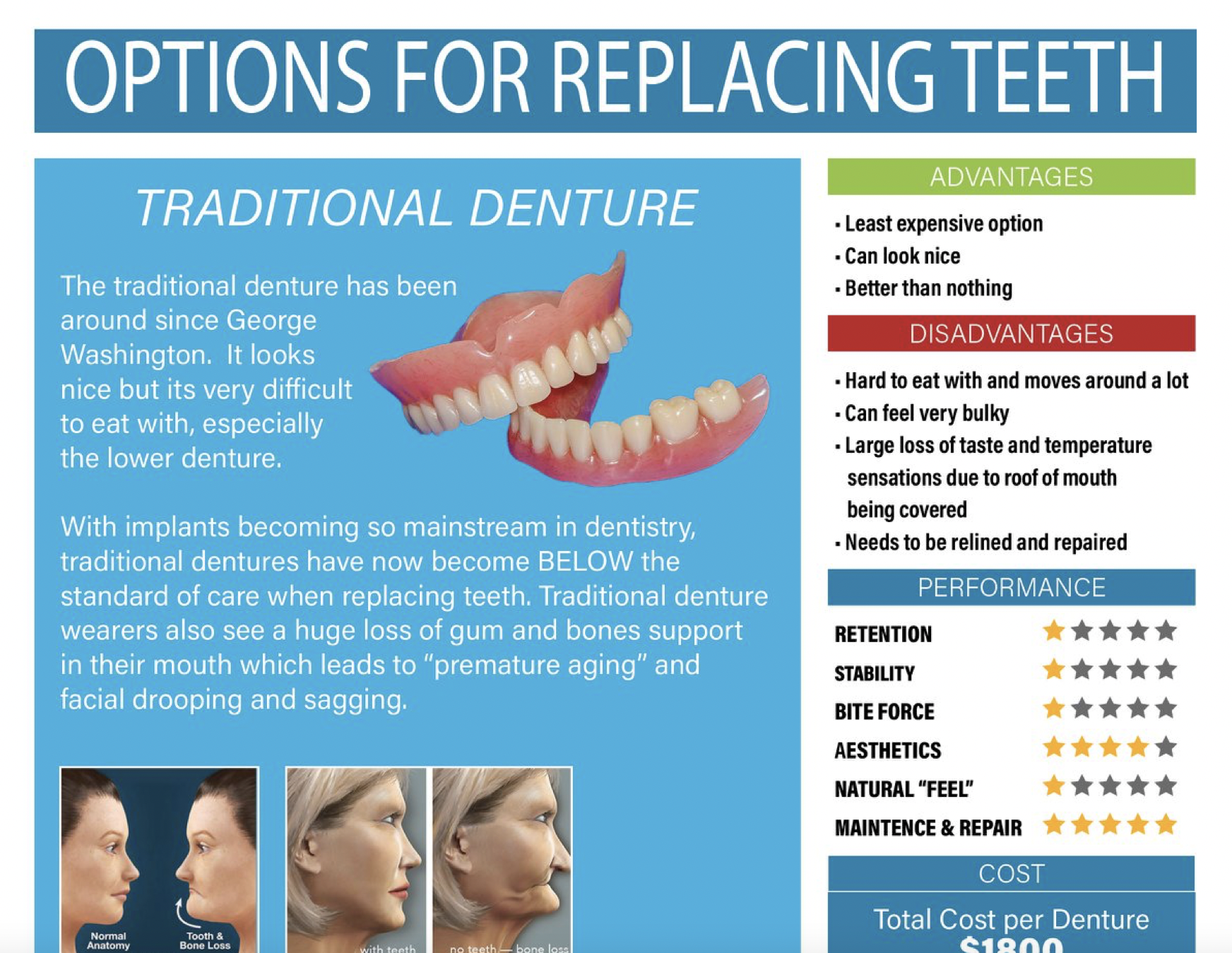 Options for New Teeth - Dental Success Network
