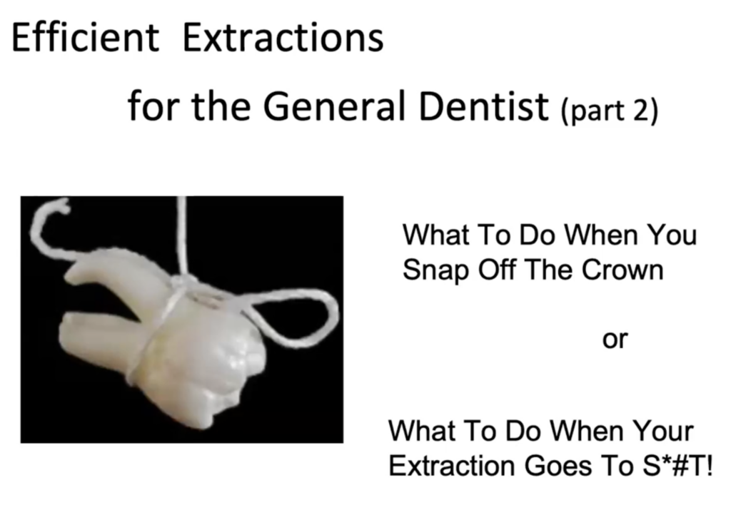 What to do When Your Extractions Go to S***! Pt. 2