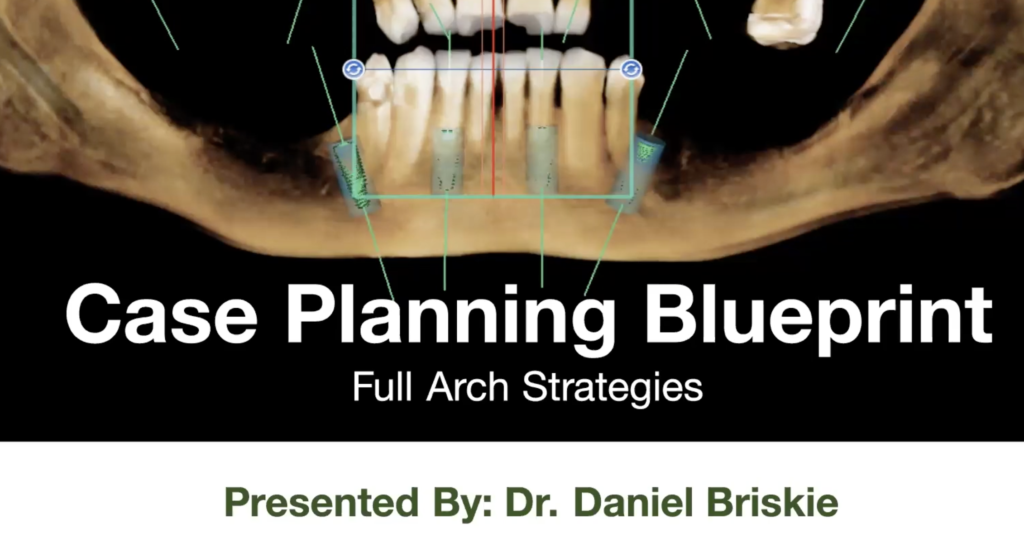 Case Planning Blueprint: Singles, Overdentures, & Full Arch Strategies with DSN/CSI